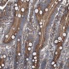Immunohistochemical staining of human duodenum shows strong cytoplasmic positivity in glandular cells.