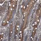 Immunohistochemical staining of human duodenum shows strong cytoplasmic positivity in glandular cells.