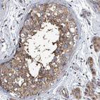 Immunohistochemical staining of human testis shows moderate cytoplasmic positivity in cells in seminiferous ducts.