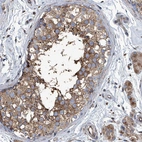 Immunohistochemical staining of human testis shows moderate cytoplasmic positivity in cells in seminiferous ducts.