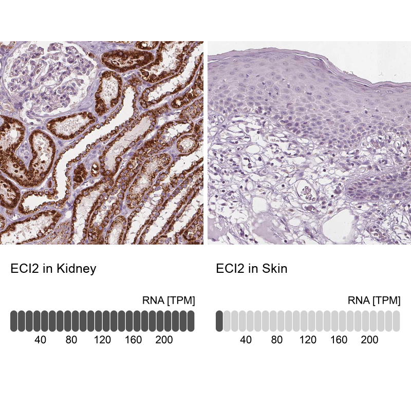 Anti-ECI2 Antibody