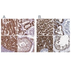 Immunohistochemical staining of human heart muscle, kidney, liver and testis using Anti-ECI2 antibody HPA031626 (A) shows similar protein distribution across tissues to independent antibody HPA022130 (B).