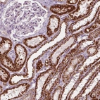 Immunohistochemical staining of human kidney shows strong granular cytoplasmic positivity in cells in tubules.