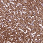 Immunohistochemical staining of human liver shows moderate granular cytoplasmic positivity in hepatocytes.