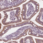 Immunohistochemical staining of human duodenum shows moderate granular cytoplasmic positivity in glandular cells.