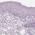 Immunohistochemical staining of human skin shows no positivity in epidermal cells as expected.