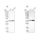 Western blot analysis using Anti-ECI2 antibody HPA031626 (A) shows similar pattern to independent antibody HPA022130 (B).