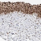 Immunohistochemical staining of human urinary bladder shows strong nuclear positivity in urothelial cells.
