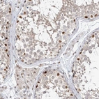 Immunohistochemical staining of human testis shows strong nuclear positivity in a subset of cells in seminiferous ducts.