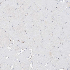 Immunohistochemical staining of human skeletal muscle shows no positivity in myocytes as expected.