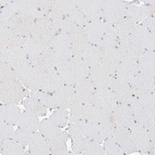 Immunohistochemical staining of human skeletal muscle shows no positivity in myocytes as expected.