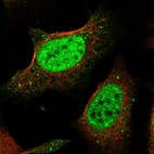 Immunofluorescent staining of human cell line U-2 OS shows localization to nucleoplasm & vesicles.