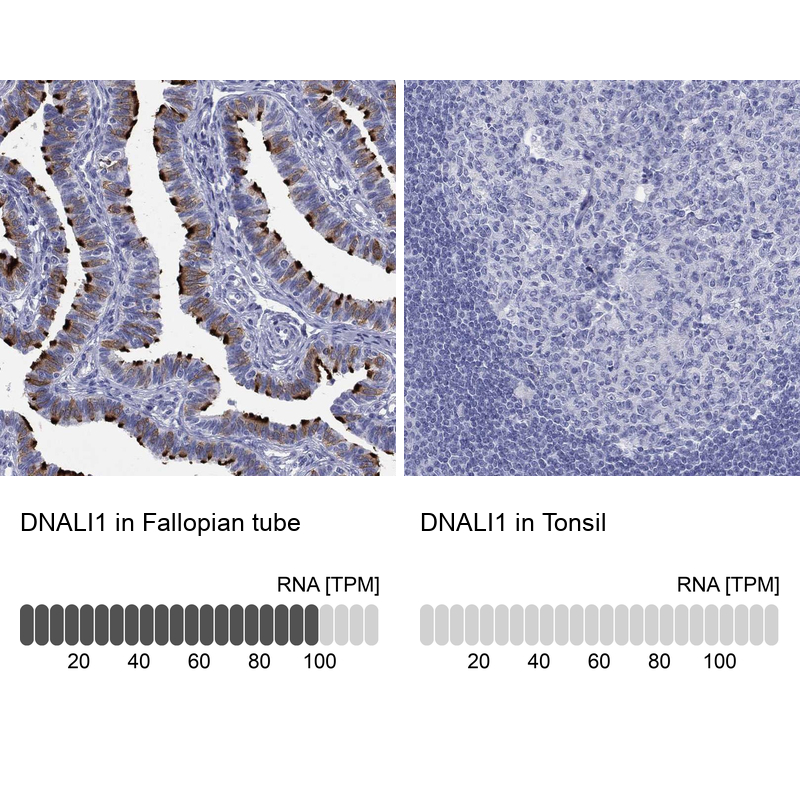 Anti-DNALI1 Antibody