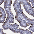 Immunohistochemical staining of human fallopian tube shows high expression.