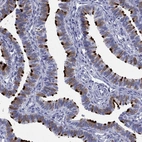 Immunohistochemical staining of human fallopian tube shows high expression.