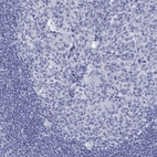 Immunohistochemical staining of human tonsil shows low expression as expected.