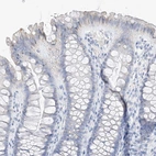 Immunohistochemical staining of human colon shows weak cytoplasmic positivity in glandular cells.