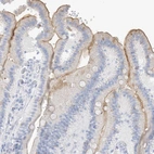 Immunohistochemical staining of human duodenum shows moderate membranous positivity in glandular cells.