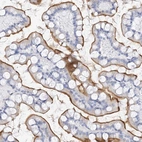 Immunohistochemical staining of human small intestine shows moderate membranous positivity in glandular cells.