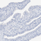 Immunohistochemical staining of human fallopian tube shows no positivity in glandular cells as expected.