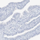Immunohistochemical staining of human fallopian tube shows no positivity in glandular cells as expected.
