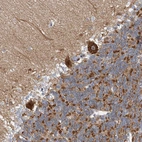 Anti-CPNE6 Antibody