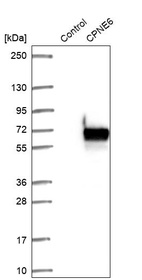 Western blot analysis in control (vector only transfected HEK293T lysate) and CPNE6 over-expression lysate (Co-expressed with a C-terminal myc-DDK tag (~3.1 kDa) in mammalian HEK293T cells, LY401820).