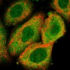 Immunofluorescent staining of human cell line A549 shows localization to nucleoplasm & cytosol.