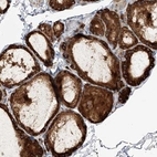 Anti-NFATC4 Antibody