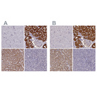 Immunohistochemical staining of human cerebral cortex, kidney, liver and pancreas using Anti-PAH antibody HPA031642 (A) shows similar protein distribution across tissues to independent antibody HPA028407 (B).