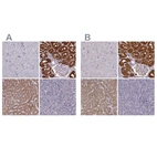 Immunohistochemical staining of human cerebral cortex, kidney, liver and pancreas using Anti-PAH antibody HPA031642 (A) shows similar protein distribution across tissues to independent antibody HPA028407 (B).