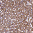 Immunohistochemical staining of human liver shows moderate to strong cytoplasmic positivity in hepatocytes.