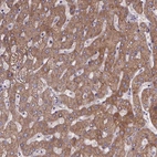 Immunohistochemical staining of human liver shows moderate to strong cytoplasmic positivity in hepatocytes.
