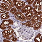 Immunohistochemical staining of human kidney shows strong cytoplasmic positivity in cells in proximal tubules.