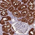 Immunohistochemical staining of human kidney shows strong cytoplasmic positivity in cells in proximal tubules.