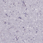 Immunohistochemical staining of human cerebral cortex shows no positivity in neurons as expected.