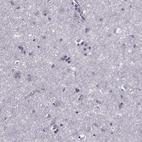 Immunohistochemical staining of human cerebral cortex shows no positivity in neurons as expected.