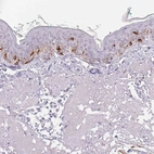 Immunohistochemical staining of human skin shows high expression.