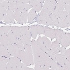 Immunohistochemical staining of human skeletal muscle shows low expression as expected.