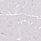 Immunohistochemical staining of human skeletal muscle shows low expression as expected.