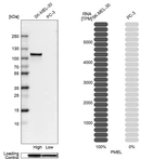 Western blot analysis in human cell lines SK-MEL-30 and PC-3 using Anti-PMEL antibody. Corresponding PMEL RNA-seq data are presented for the same cell lines. Loading control: Anti-GAPDH.