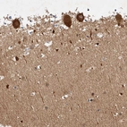 Immunohistochemical staining of human cerebellum shows strong granular cytoplasmic positivity in Purkinje cells.