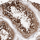 Immunohistochemical staining of human testis shows strong granular cytoplasmic positivity in cells in seminiferous ducts.