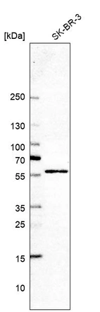 Western blot analysis in human cell line SK-BR-3.