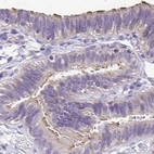 Immunohistochemical staining of human fallopian tube using Anti-ANKRD45 antibody HPA031655.