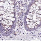 Immunohistochemical staining of human colon using Anti-ANKRD45 antibody HPA031655.