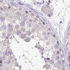 Immunohistochemical staining of human testis using Anti-ANKRD45 antibody HPA031655.