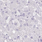Immunohistochemical staining of human liver using Anti-ANKRD45 antibody HPA031655.