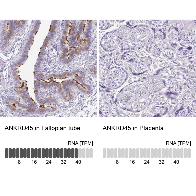 Anti-ANKRD45 Antibody