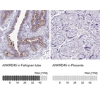 Anti-ANKRD45 Antibody